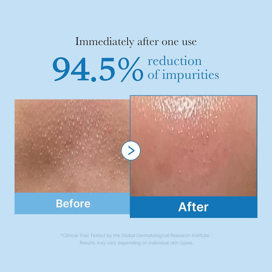 90.6% concentration of 11 plant-based oils for mild yet effective cleansing