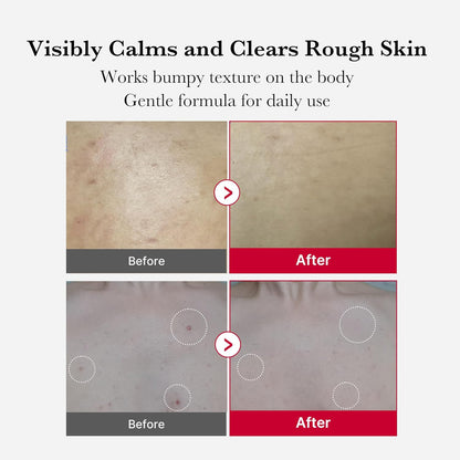 1-minute rinse-off chemical exfoliant (no scrubbing required)