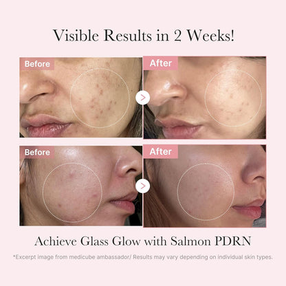 4-step layering routine: prep, treat, firm, mask