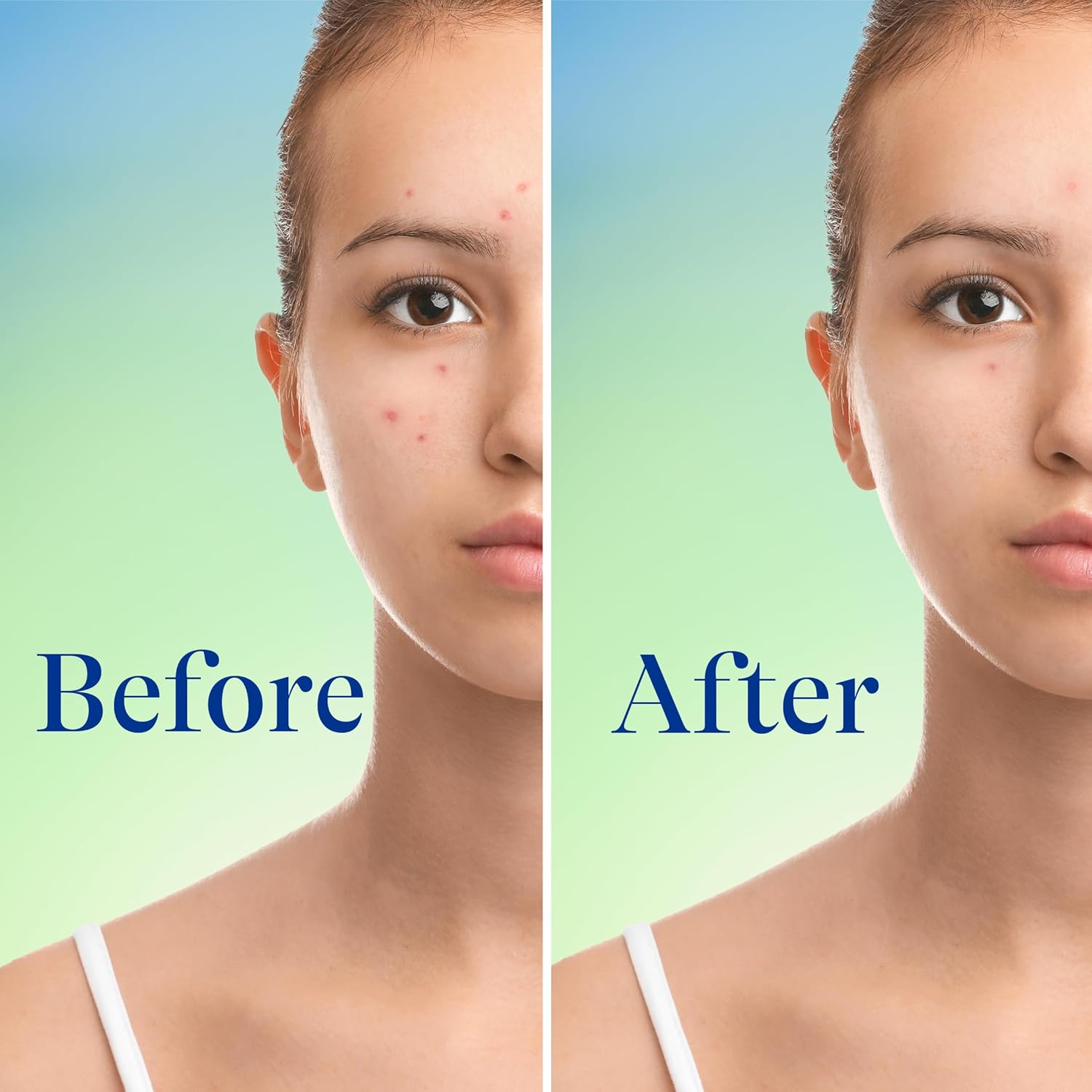 5 oz bottle designed for both facial and full-body application