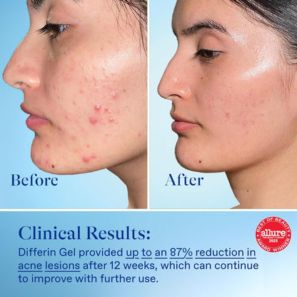 dermatologist recommended for acne-prone and sensitive skin types