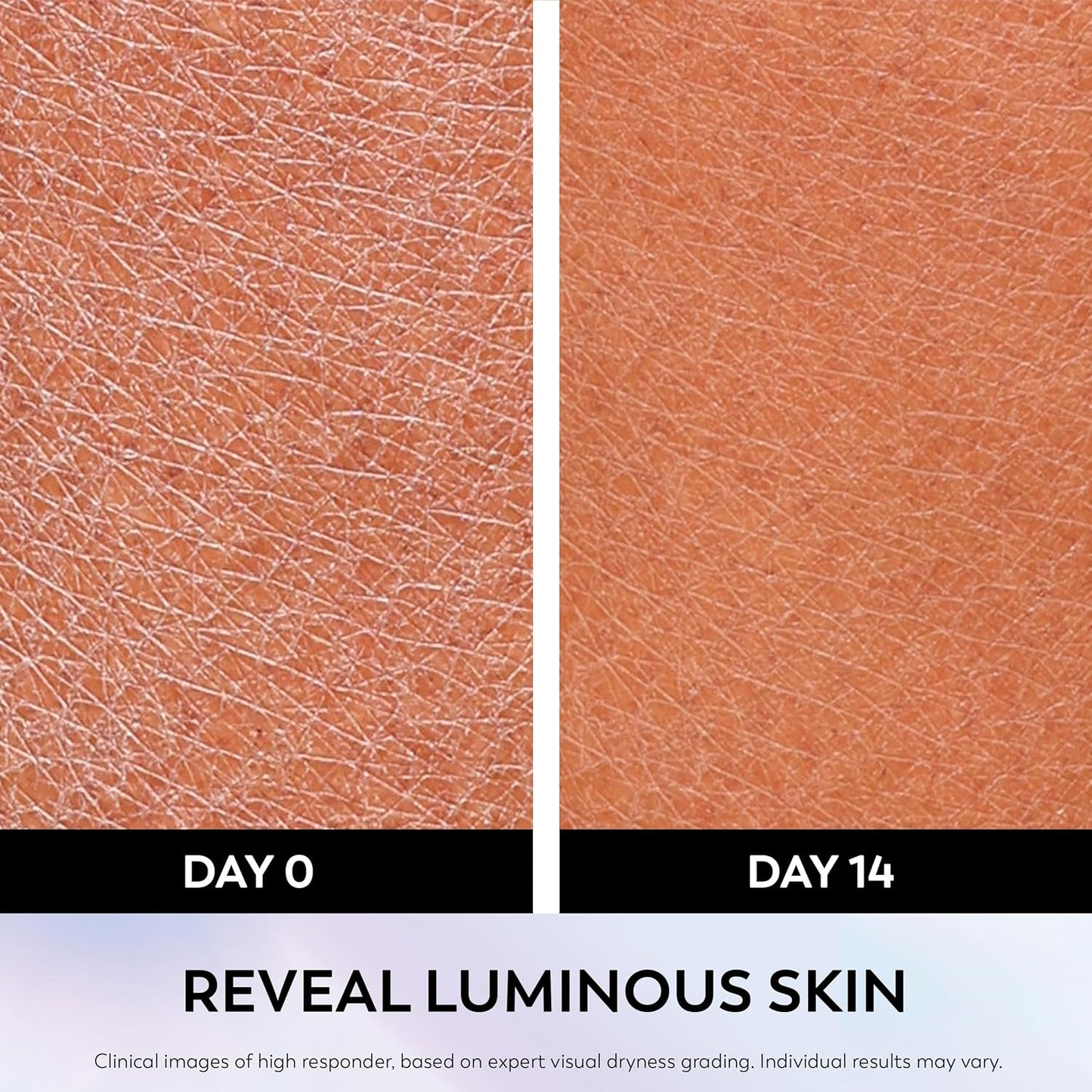 collagen peptide for firming support