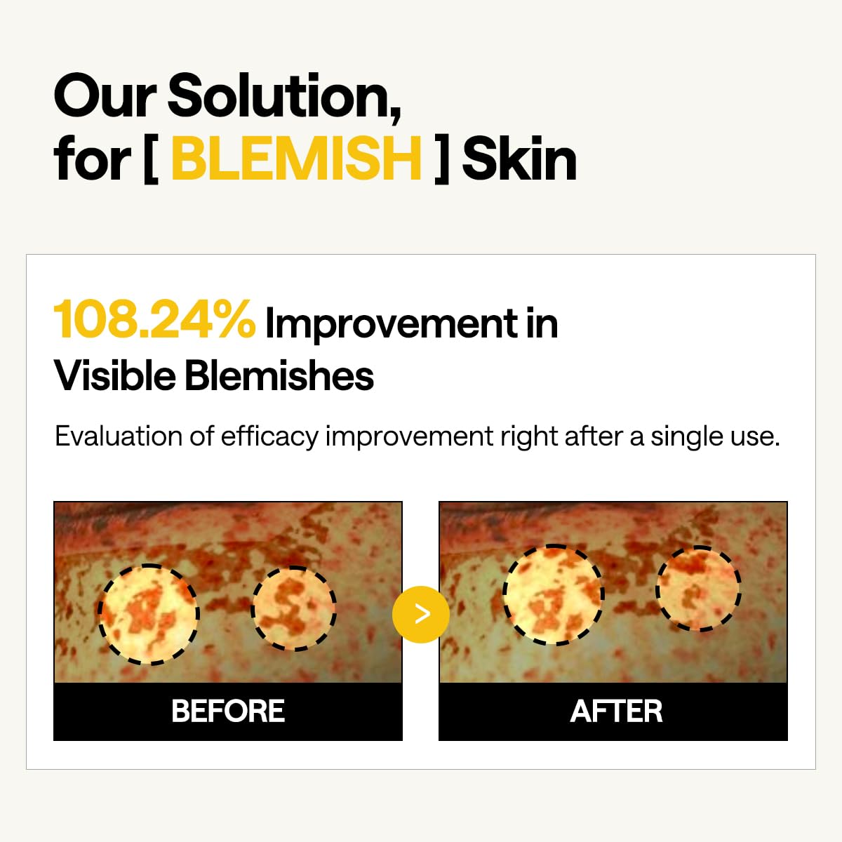 95% retinol liposome ampoule for firming and elasticity