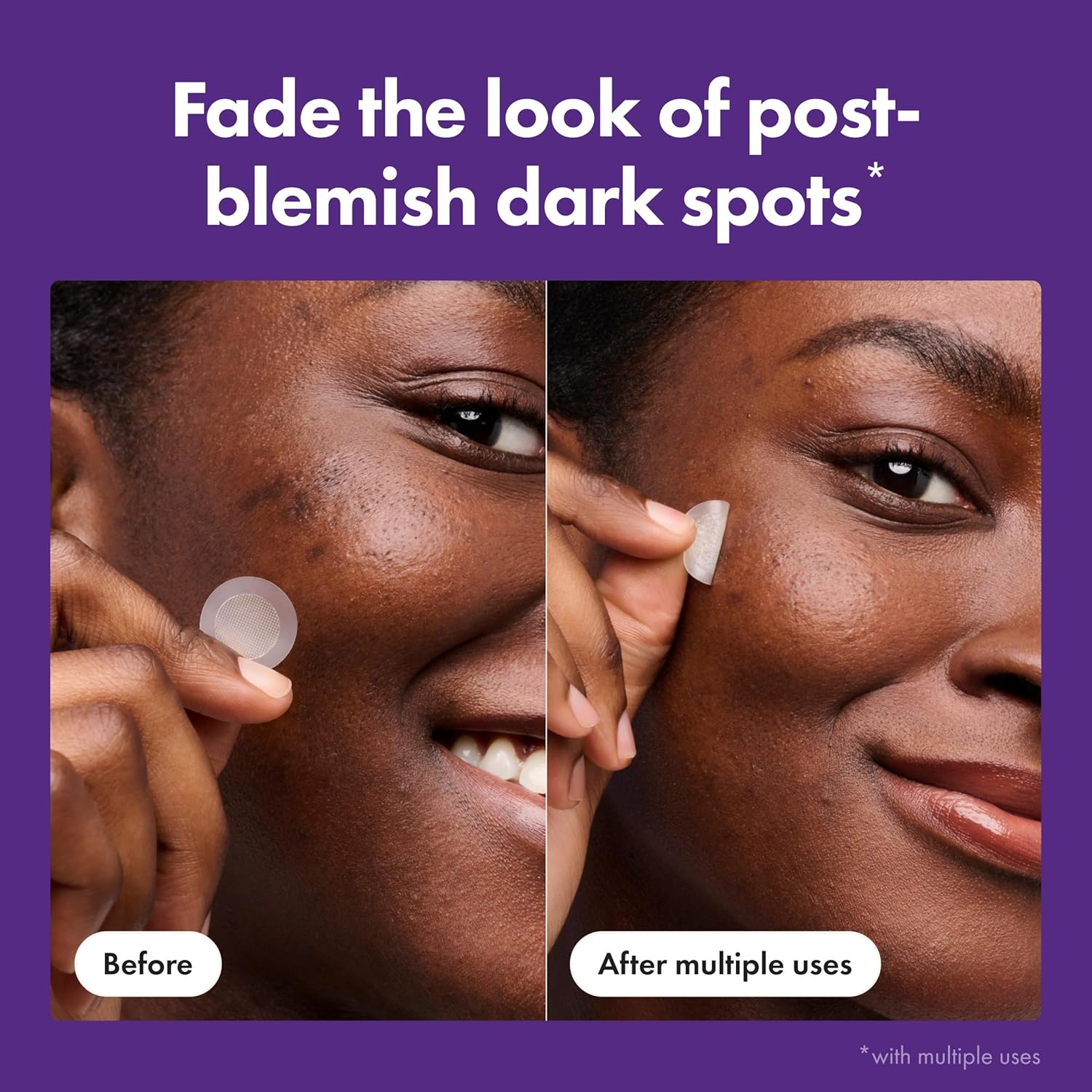 active ingredient blend: tranexamic acid, niacinamide, vitamin c, and licorice root