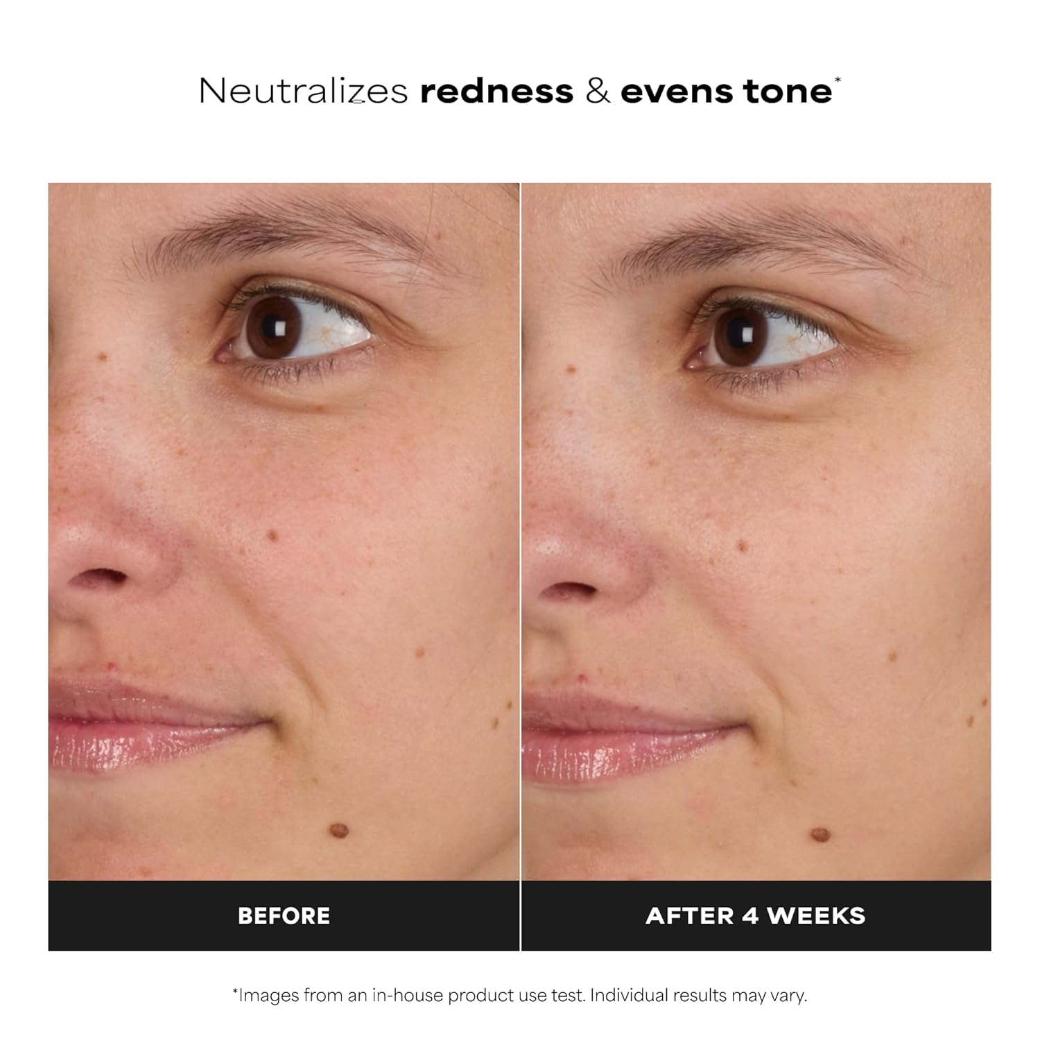 alcohol-free, fragrance-free, unscented formulation safe for sensitive skin