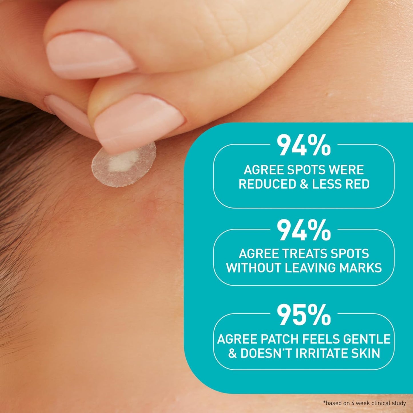 CeraVe Blemish Barrier Patches Allergy-Tested, Skin-Safe Spot Treatment for Sensitive and Reactive Skin Types