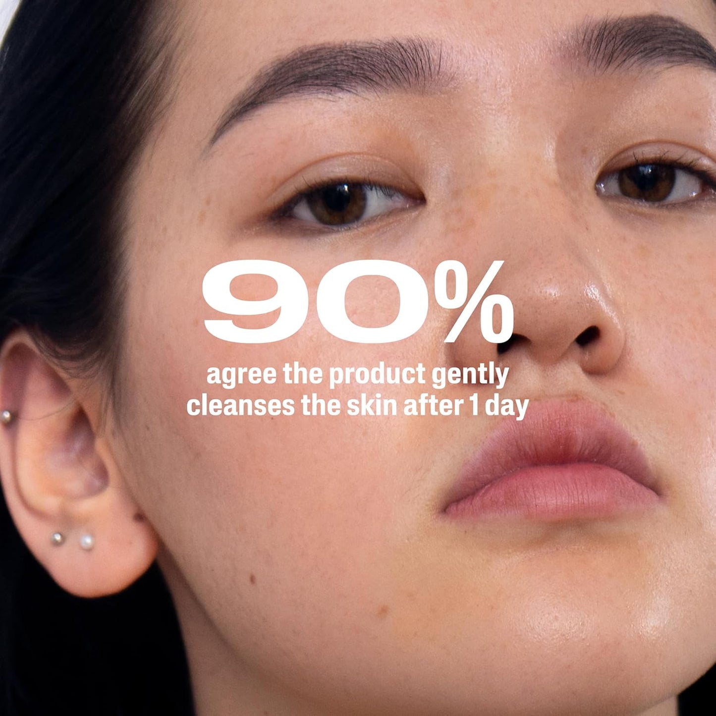 Cetaphil Gentle Clear Acne Cleanser – Dermatologist-Recommended Sensitive-Skin Wash With Hypoallergenic, Fragrance-Free Formula