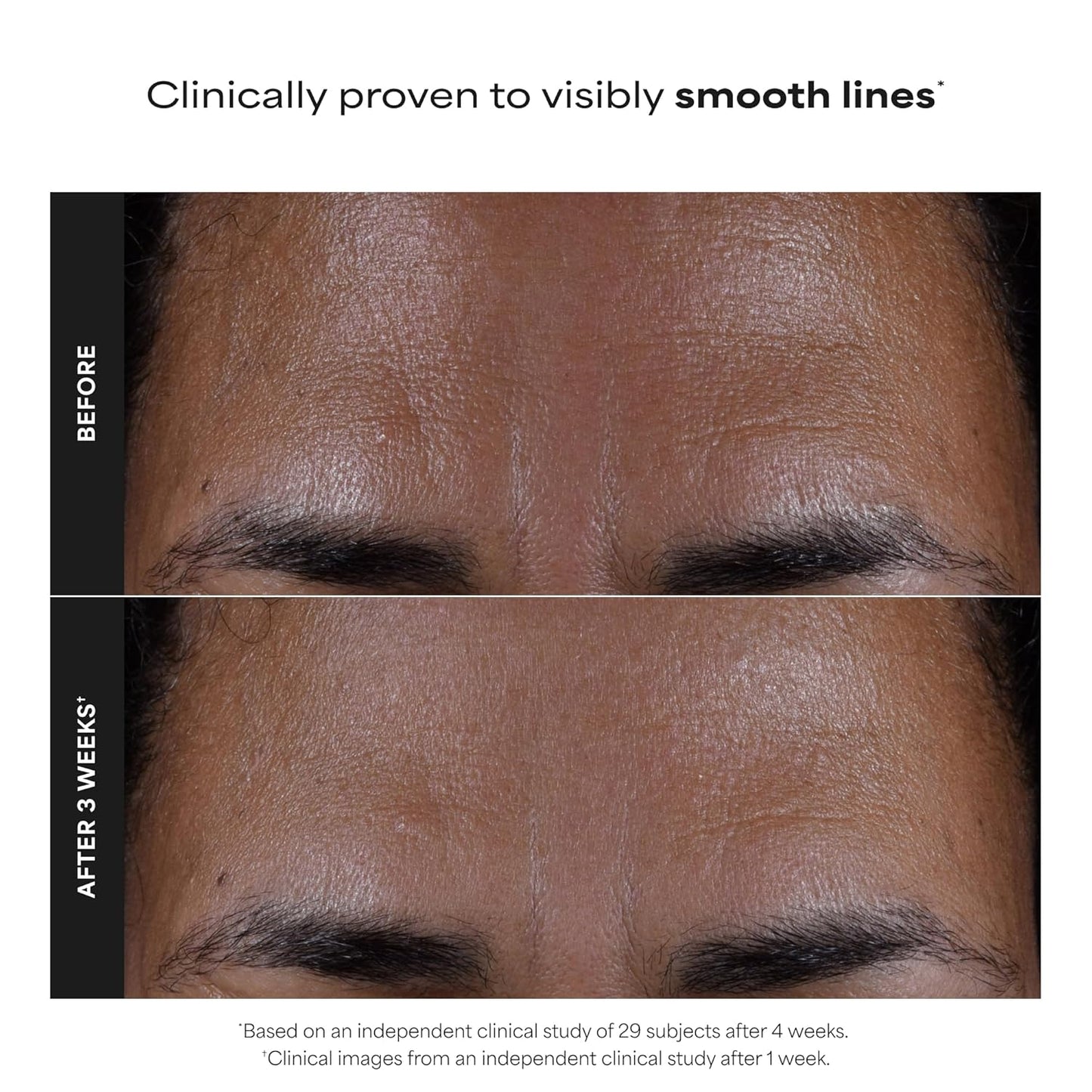 chemical (non-abrasive) exfoliation suitable for all skin types