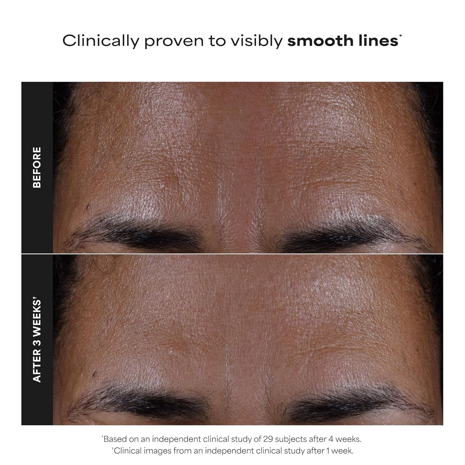 chemical (non-abrasive) exfoliation suitable for all skin types