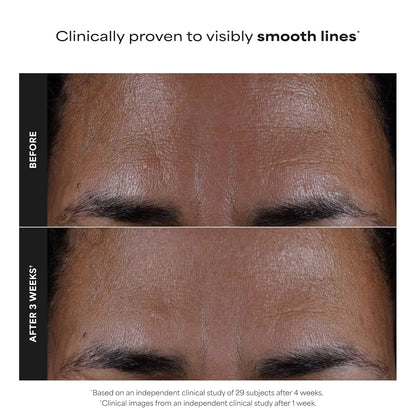 chemical (non-abrasive) exfoliation suitable for all skin types