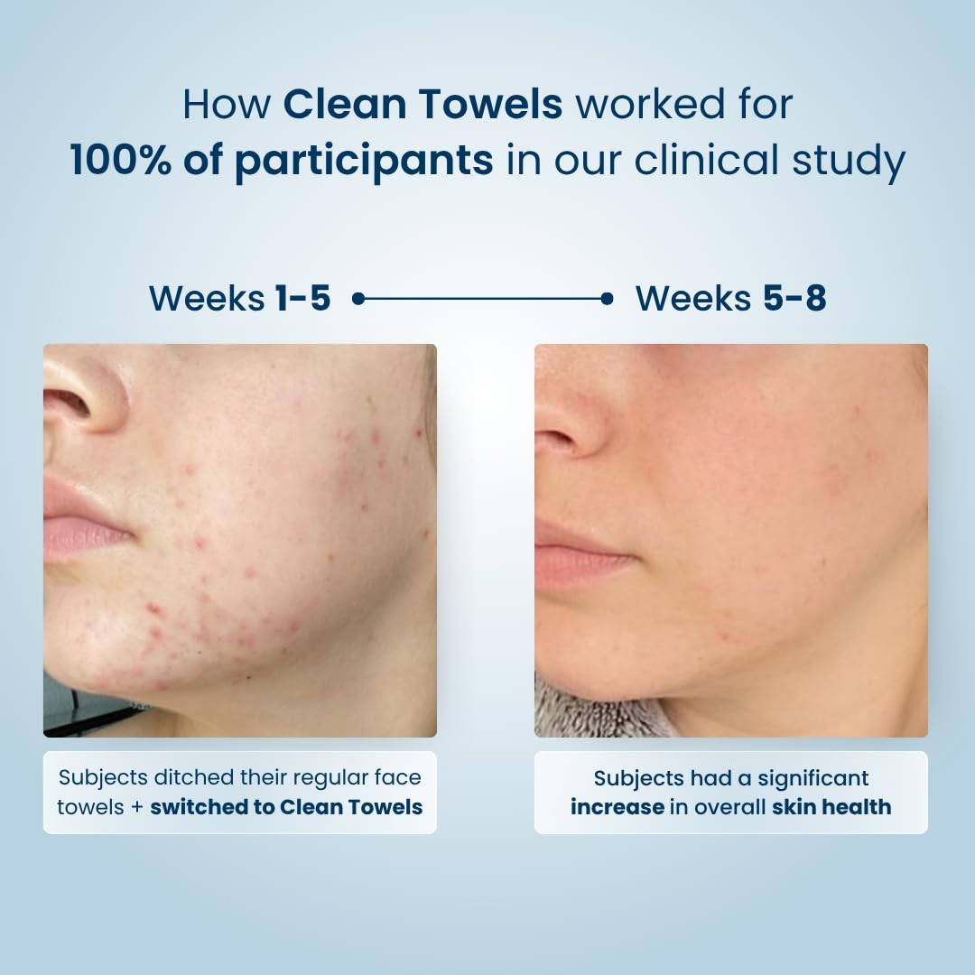 Clean Skin Club Clean Towels® – Spa-Style Self-Care Towelettes for the Bathroom Counter, 25 Ct