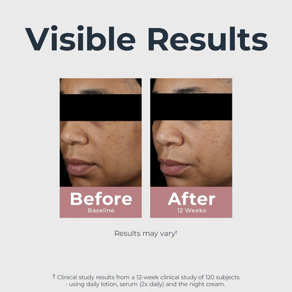 clinically proven for all skin types including sensitive skin