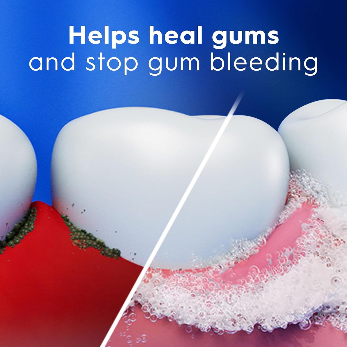 Crest Pro-Health Gum Detoxify Plus – Nightly Gum Healing Ritual, 3-Pack for Consistent Care