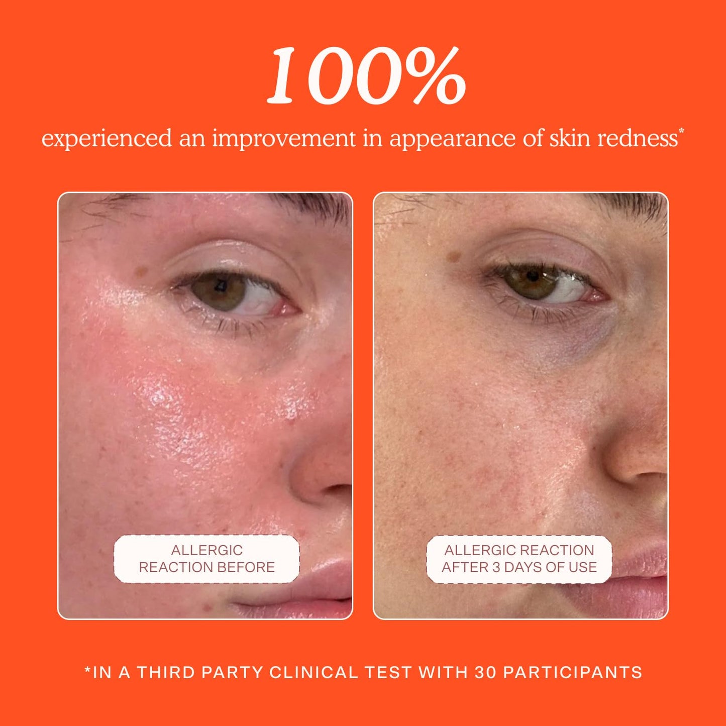 dermatologist-approved and recognized by the national eczema association and two other u.s. skin health bodies
