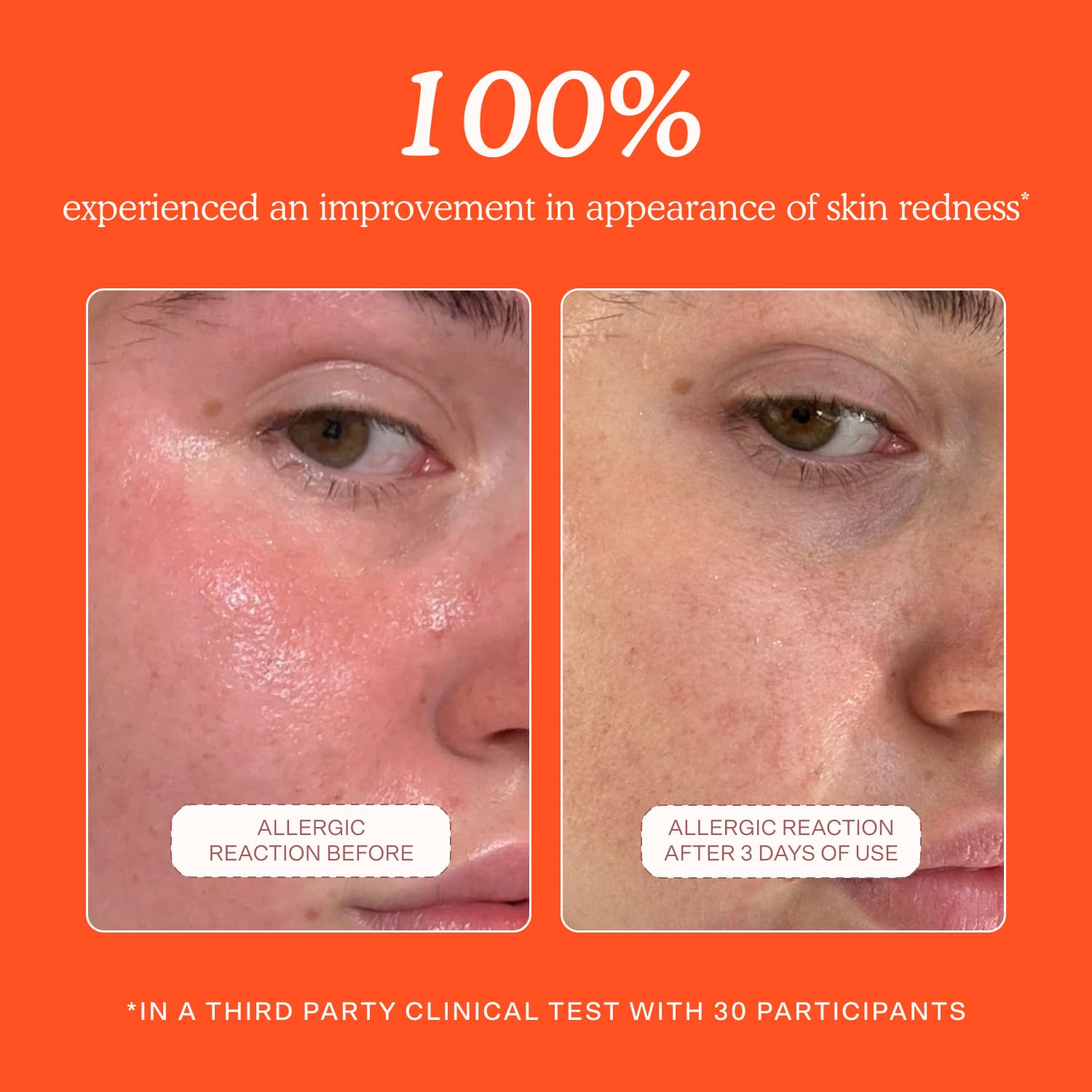 dermatologist-approved and recognized by the national eczema association and two other u.s. skin health bodies