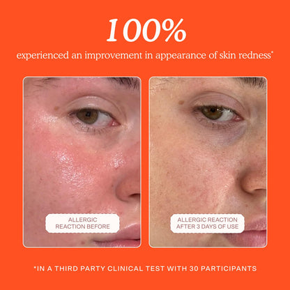 dermatologist-approved and recognized by the national eczema association and two other u.s. skin health bodies