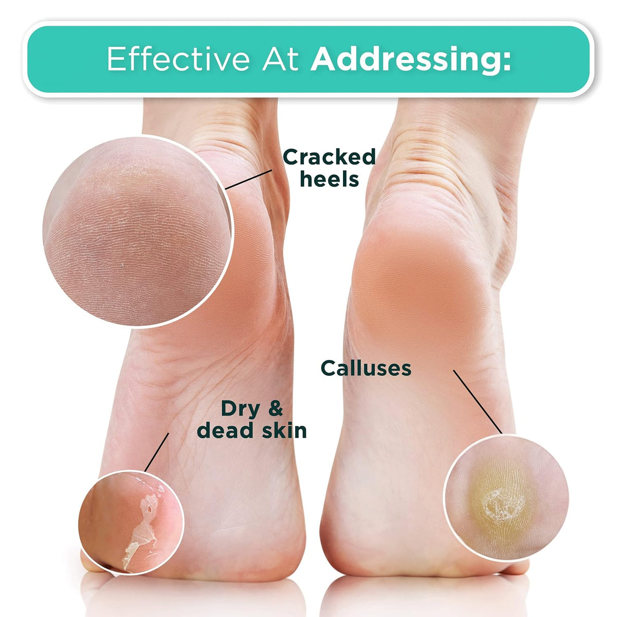 DERMORA Foot Peel Mask – Relaxing Foot Care Ritual, No-Scrub Callus Remover for Evenings In