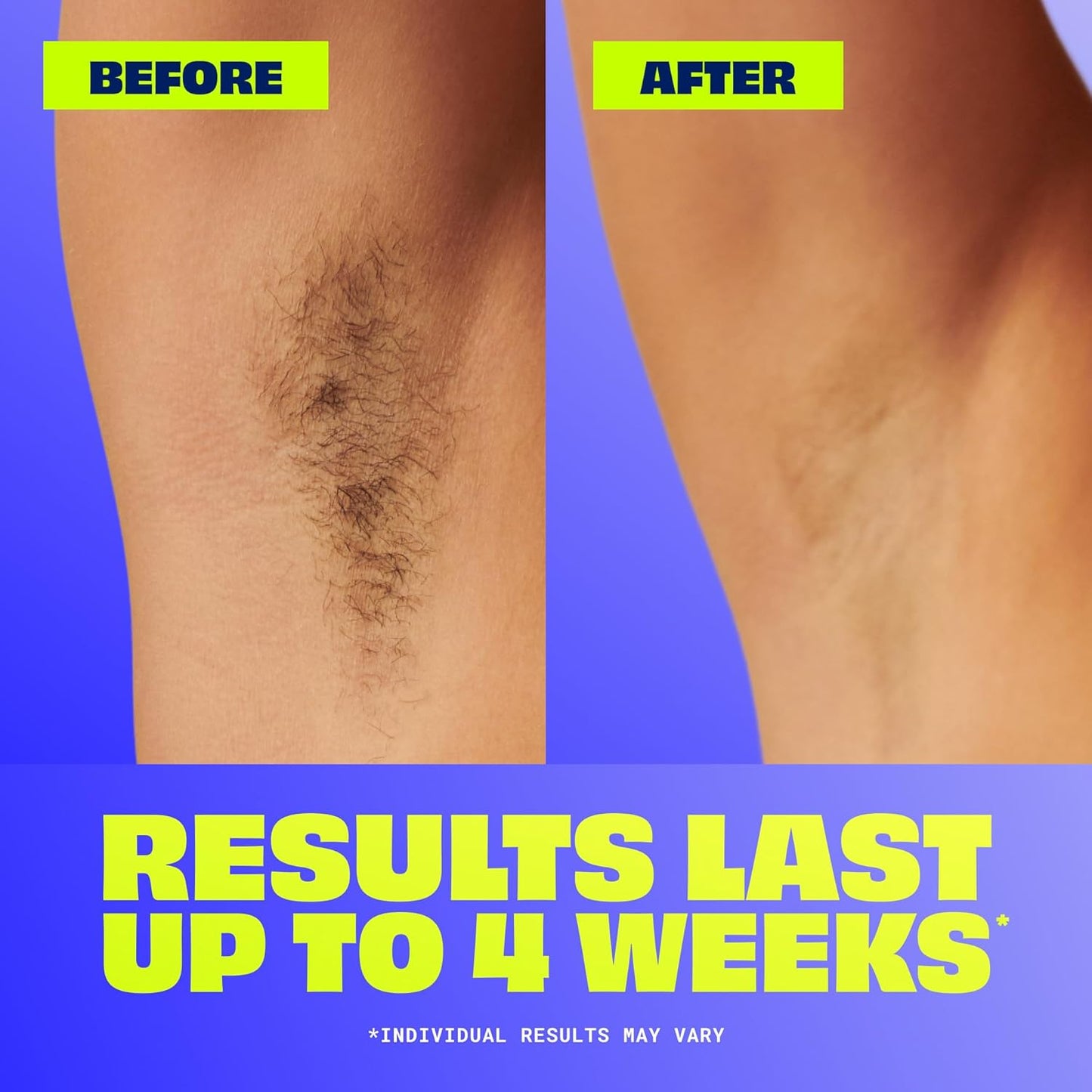 effective on short stubborn hairs on legs, arms, and underarms