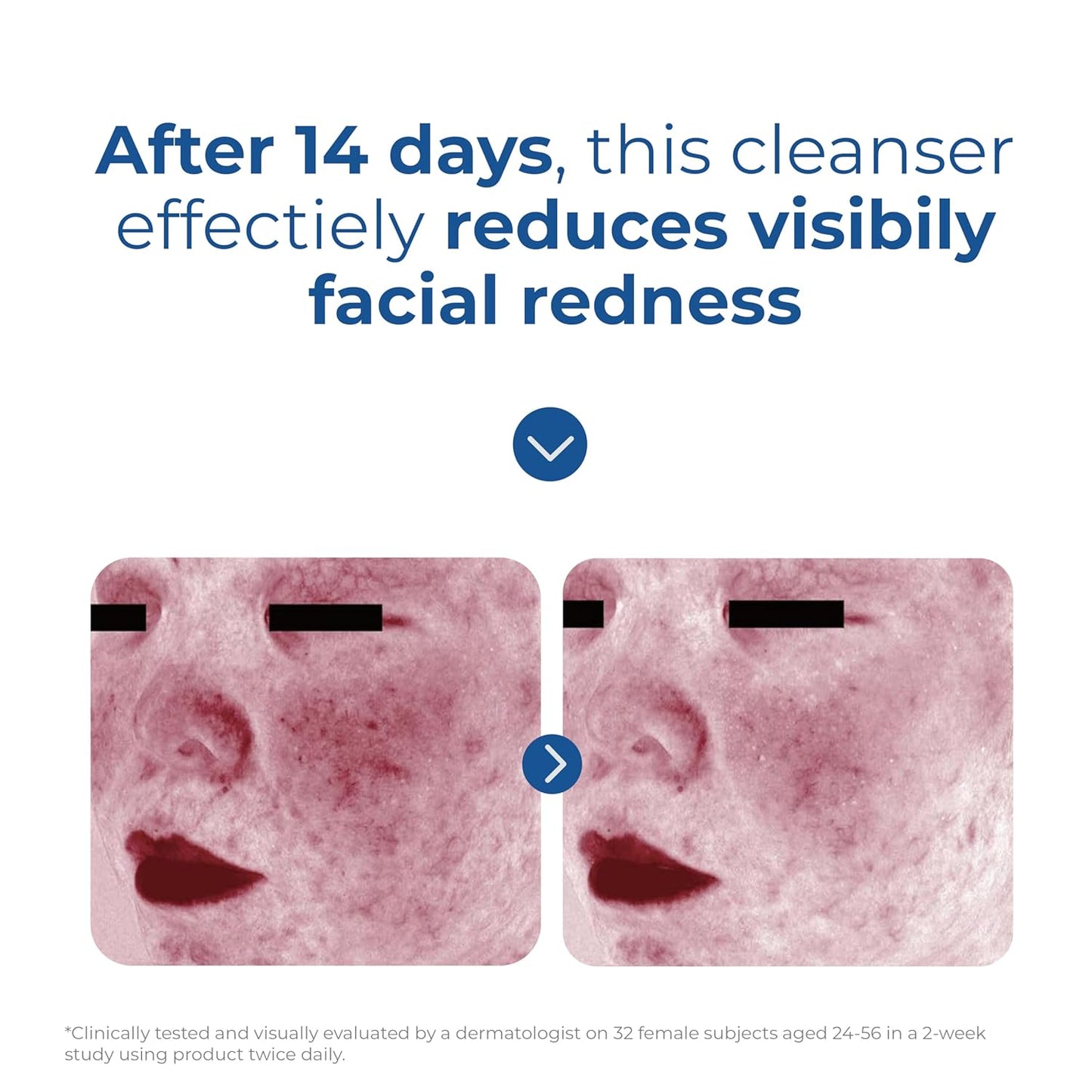 EltaMD Amino Acid Foaming Cleanser – Gentle Skincare Ritual for Calm, Nourished Skin
