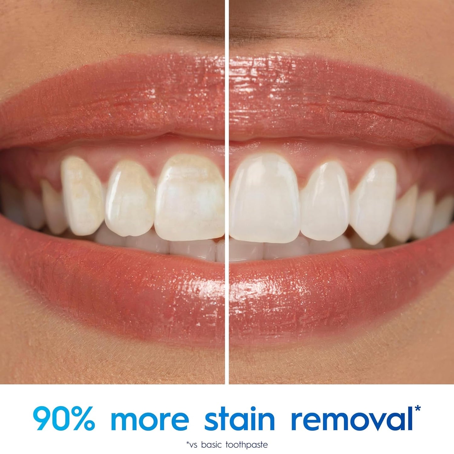 enamel-safe whitening designed for daily use without sensitivity risk