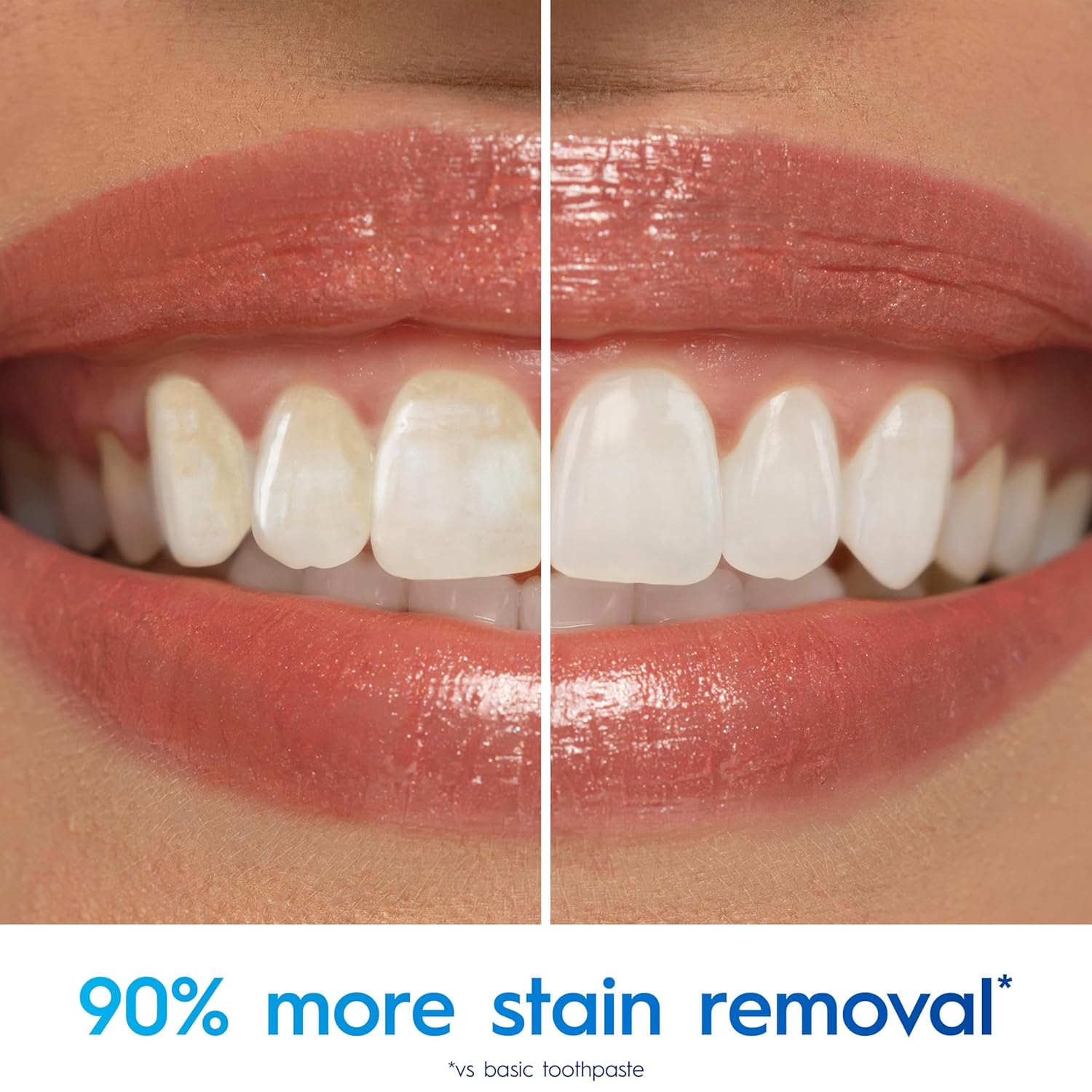 enamel-safe whitening designed for daily use without sensitivity risk