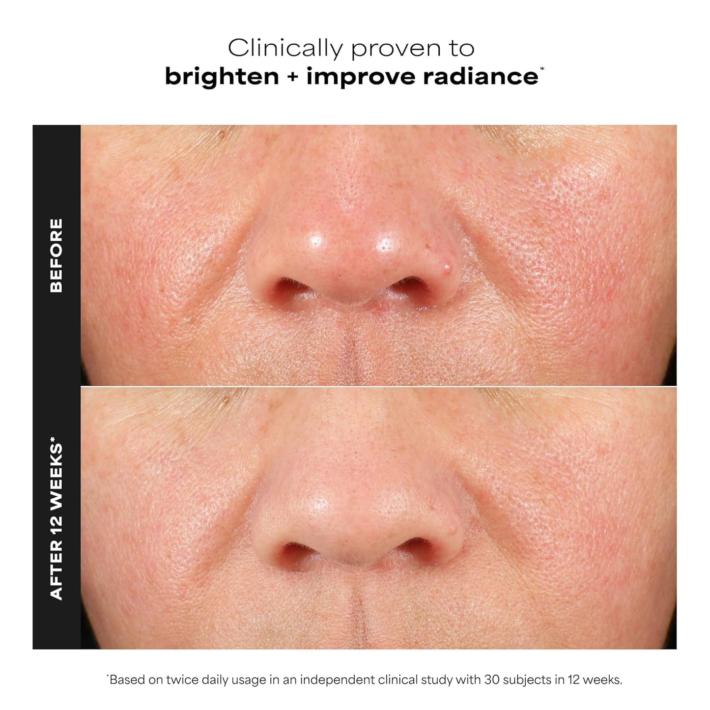 ferulic acid antioxidant for environmental damage defense