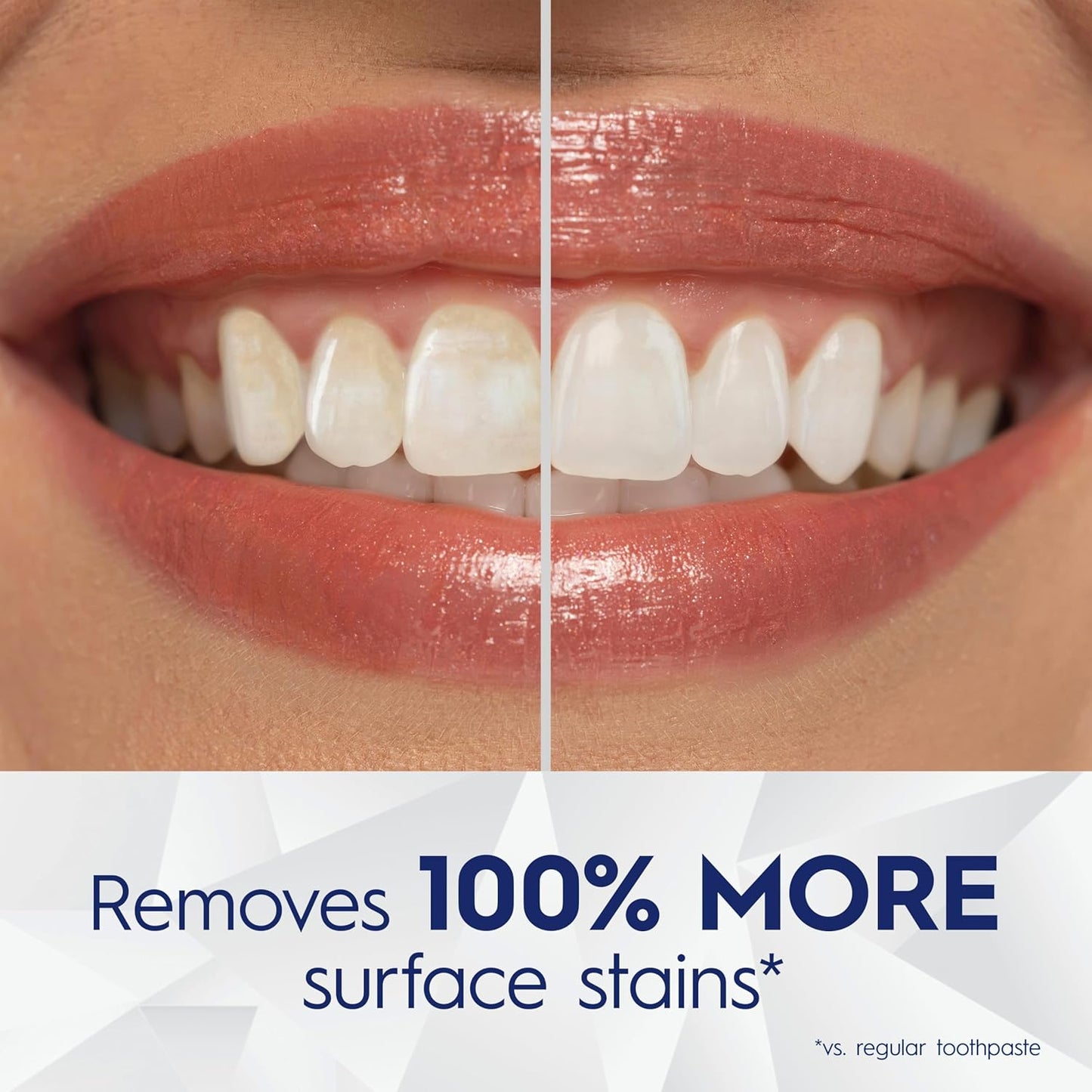 fluoride formula for anticavity protection and enamel strengthening
