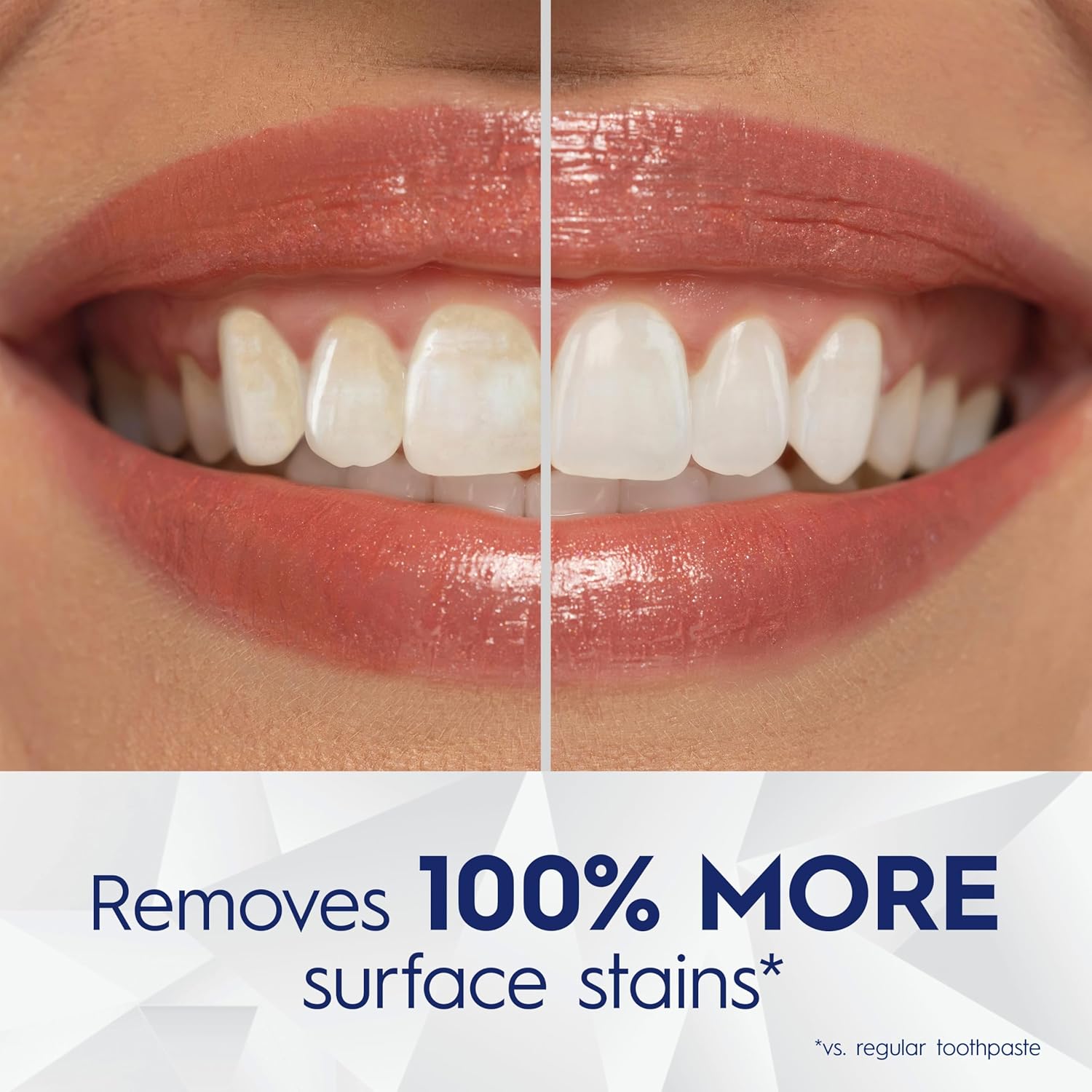 fluoride formula for anticavity protection and enamel strengthening