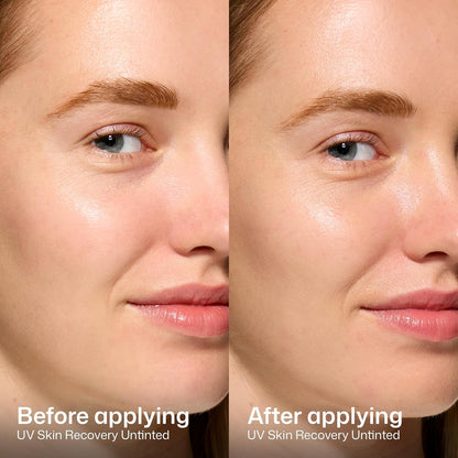 fragrance-free and safe for sensitive, rosacea-prone, and post-procedure skin