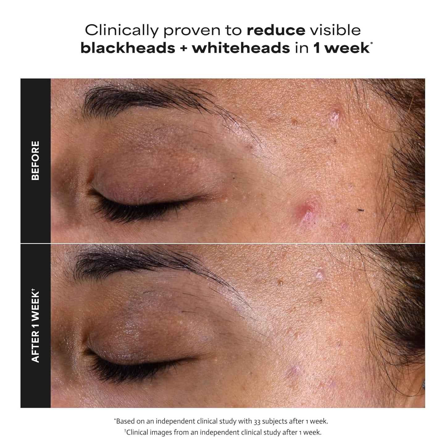 fragrance-free, paraben-free, cruelty-free formula