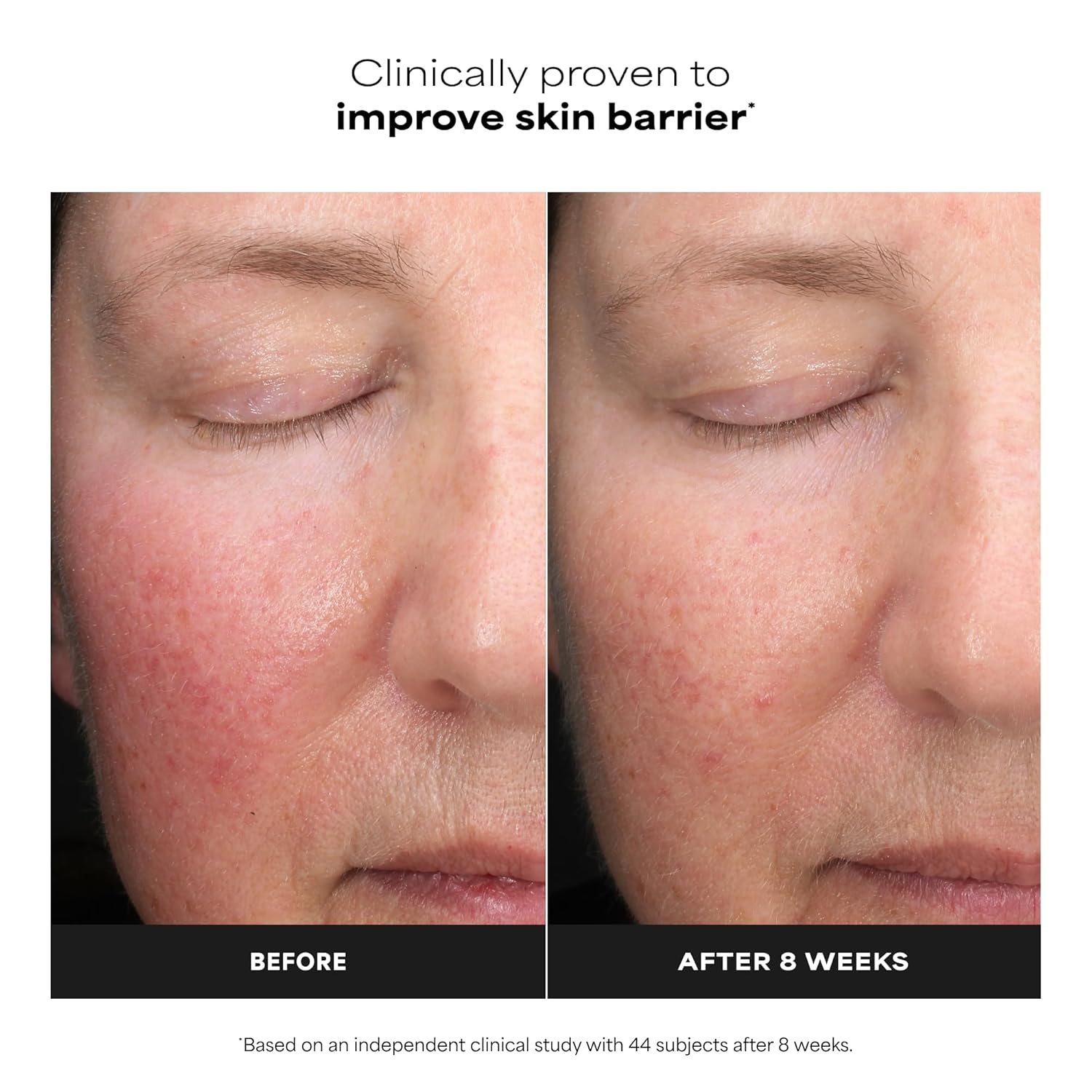 fragrance-free, unscented formula suitable for sensitive and reactive skin