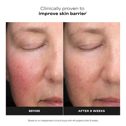 fragrance-free, unscented formula suitable for sensitive and reactive skin