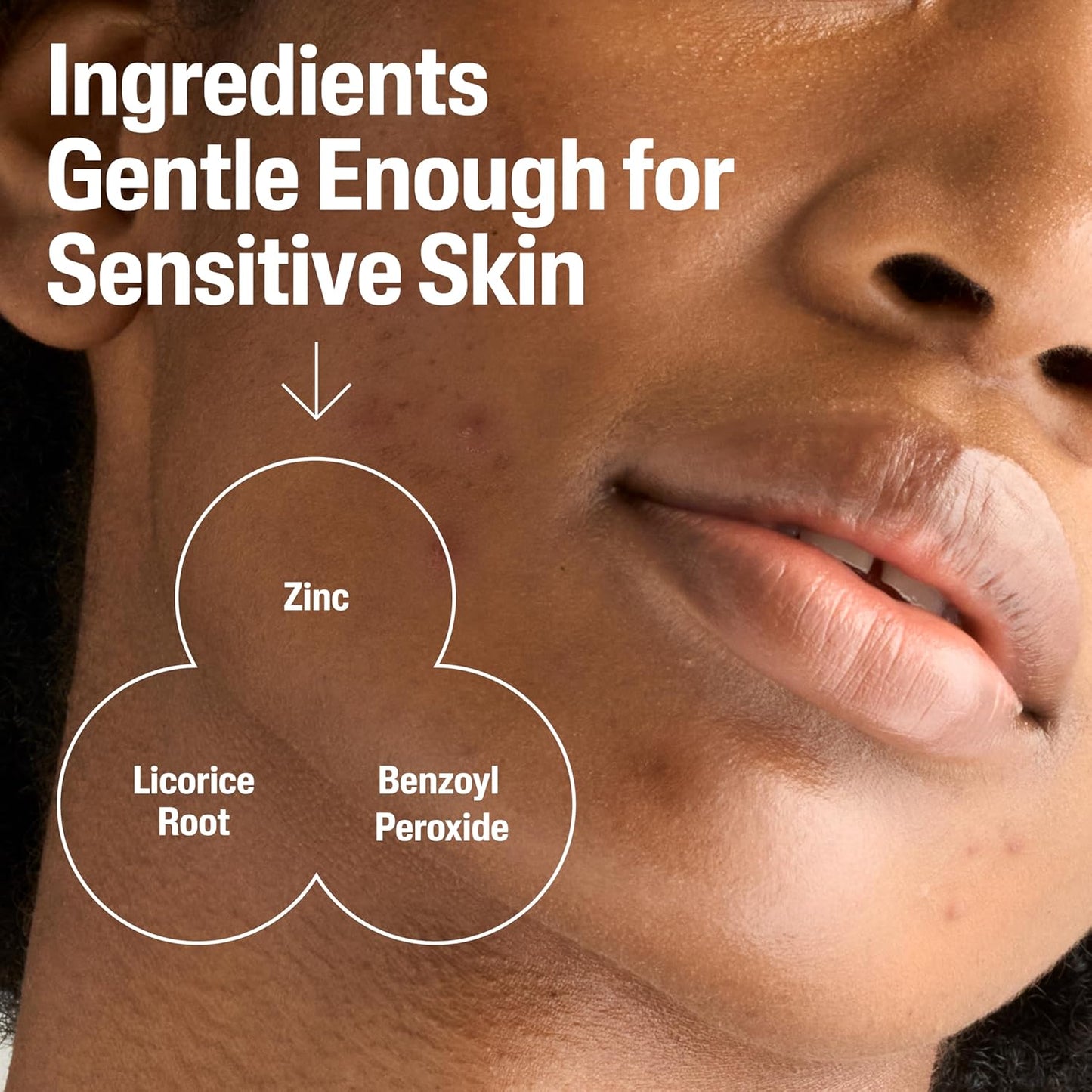 full product line available: 4.2 oz cleanser, 3 oz moisturizer, and 1 oz serum for a complete regimen