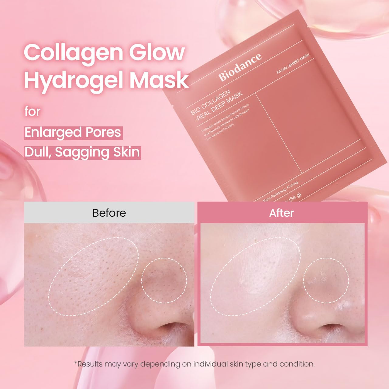 galactomyces ferment filtrate and niacinamide blend for brightening and antioxidant effect