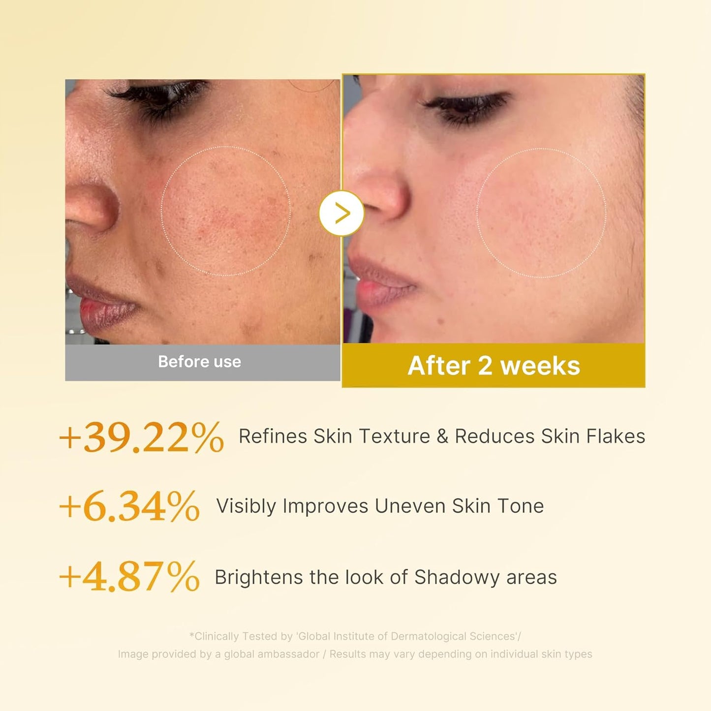 hands-free applicator tip designed for body areas like underarms, elbows, and knees
