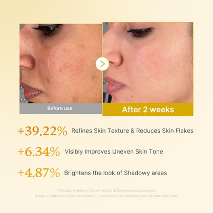 hands-free applicator tip designed for body areas like underarms, elbows, and knees