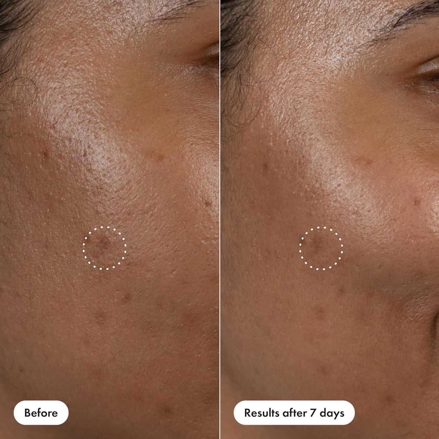 Hero Cosmetics Dark Spot Correct – Self-Care Serum Pen for Nightly Wind-Down Skincare Ritual