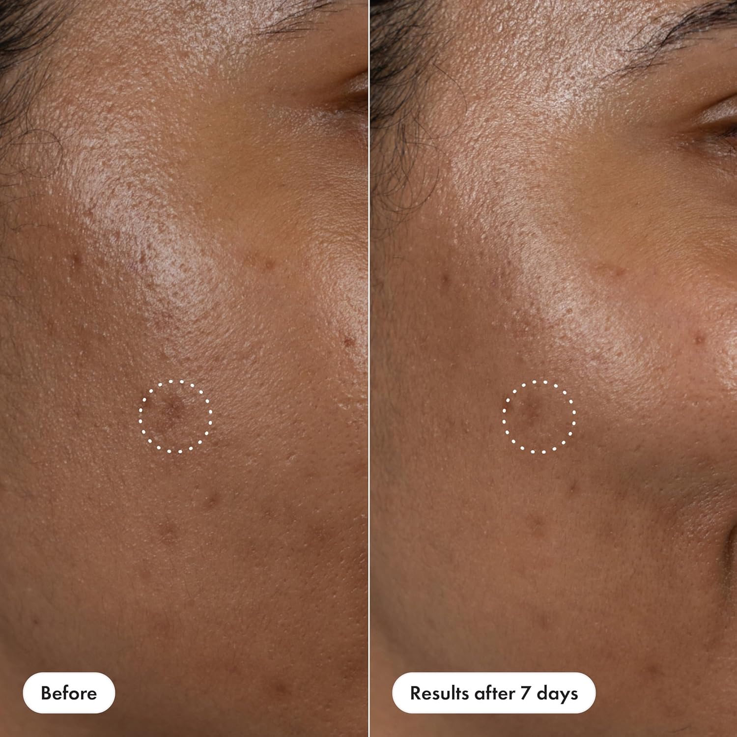 Hero Cosmetics Dark Spot Correct – Self-Care Serum Pen for Nightly Wind-Down Skincare Ritual