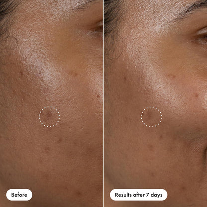 Hero Cosmetics Dark Spot Correct – Self-Care Serum Pen for Nightly Wind-Down Skincare Ritual