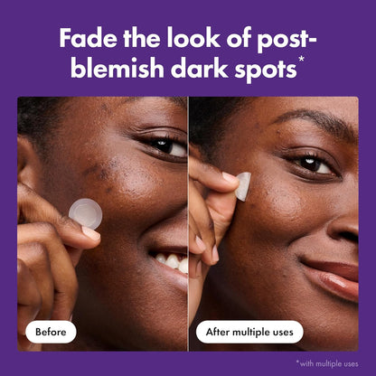 Hero Cosmetics Mighty Patch Micropoint Dark Spot Treatment – Premium Brightening Patches for Elevated Vanity Displays