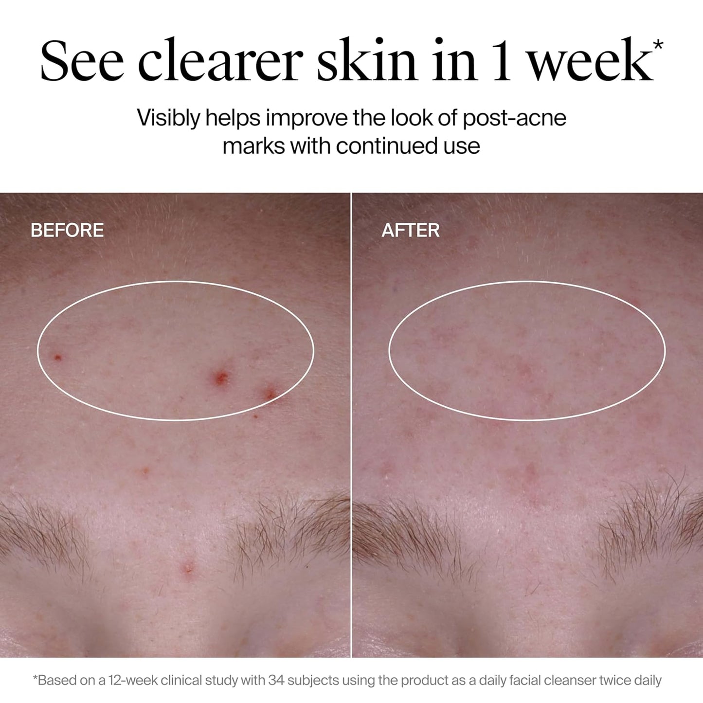 hsa/fsa eligible daily-use formulation clinically proven to reveal clearer skin in 1 week