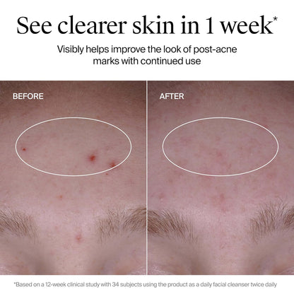 hsa/fsa eligible daily-use formulation clinically proven to reveal clearer skin in 1 week