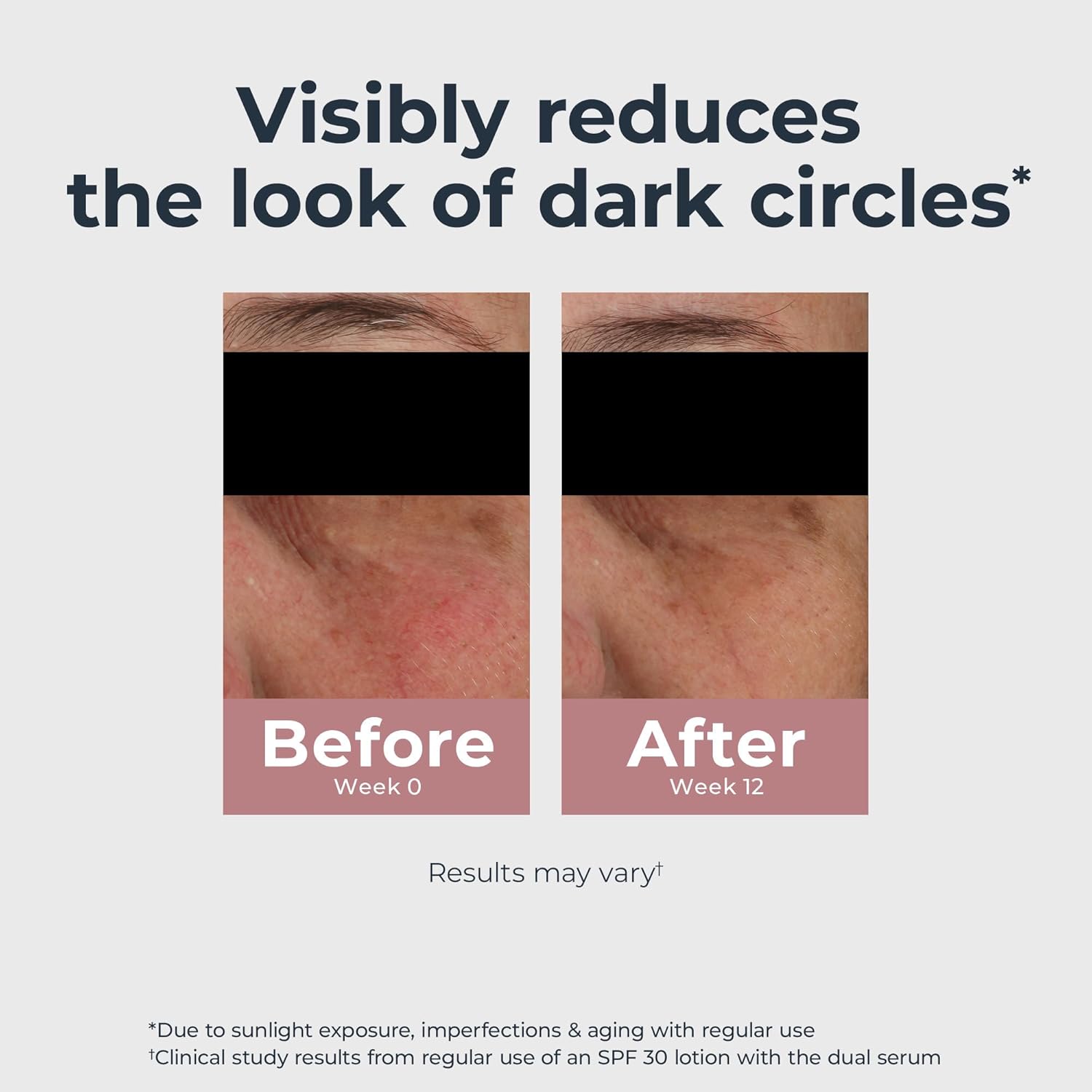 hyaluronic acid for hydration and minimizing the look of under-eye puffiness