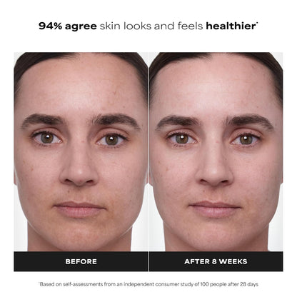 hyaluronic acid for hydration support