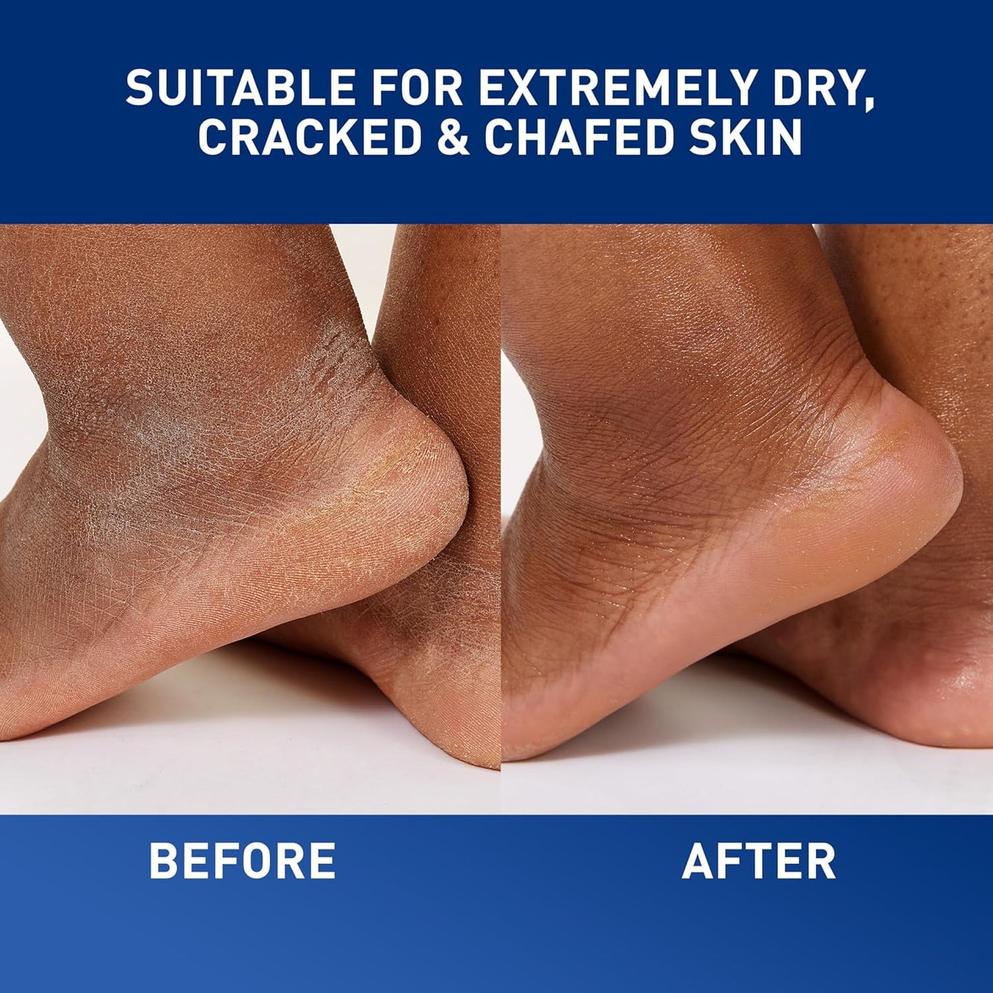 hypoallergenic and free from fragrance, lanolin, dyes, and preservatives