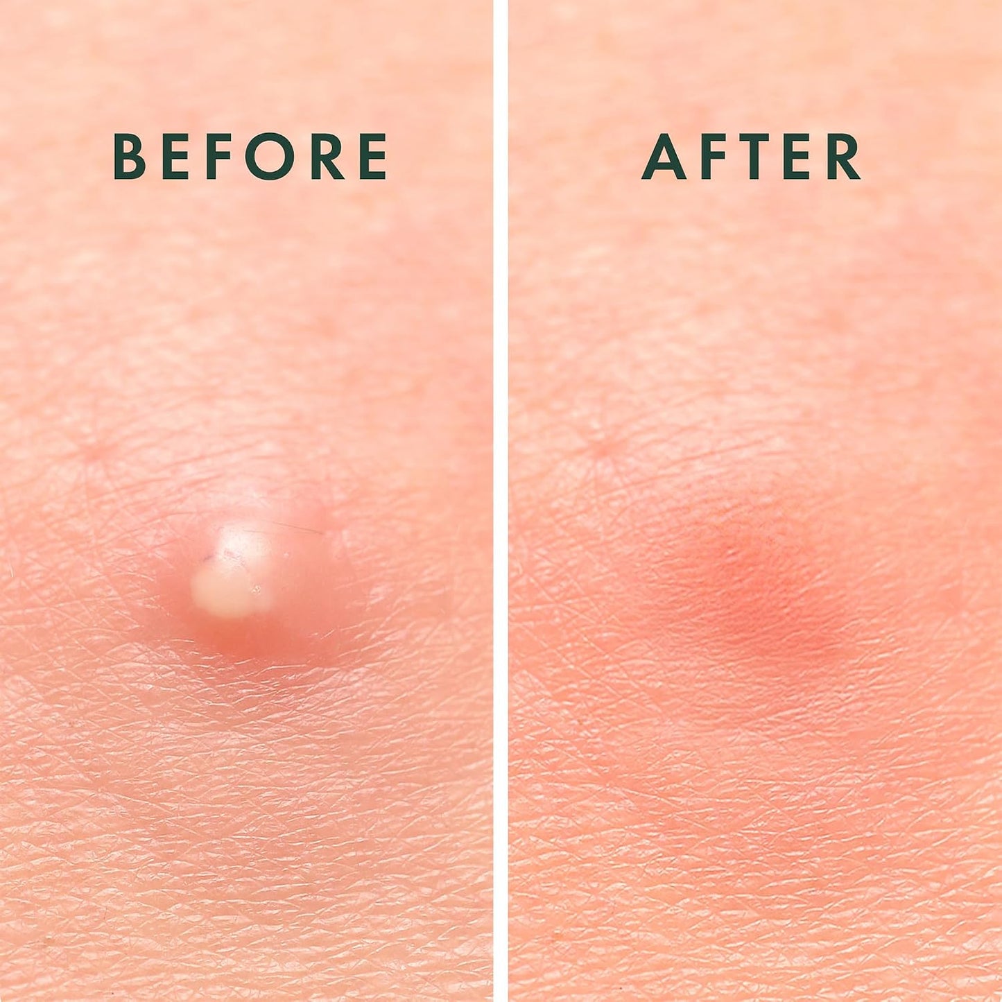 hypoallergenic, non-drying formulation safe for all skin types