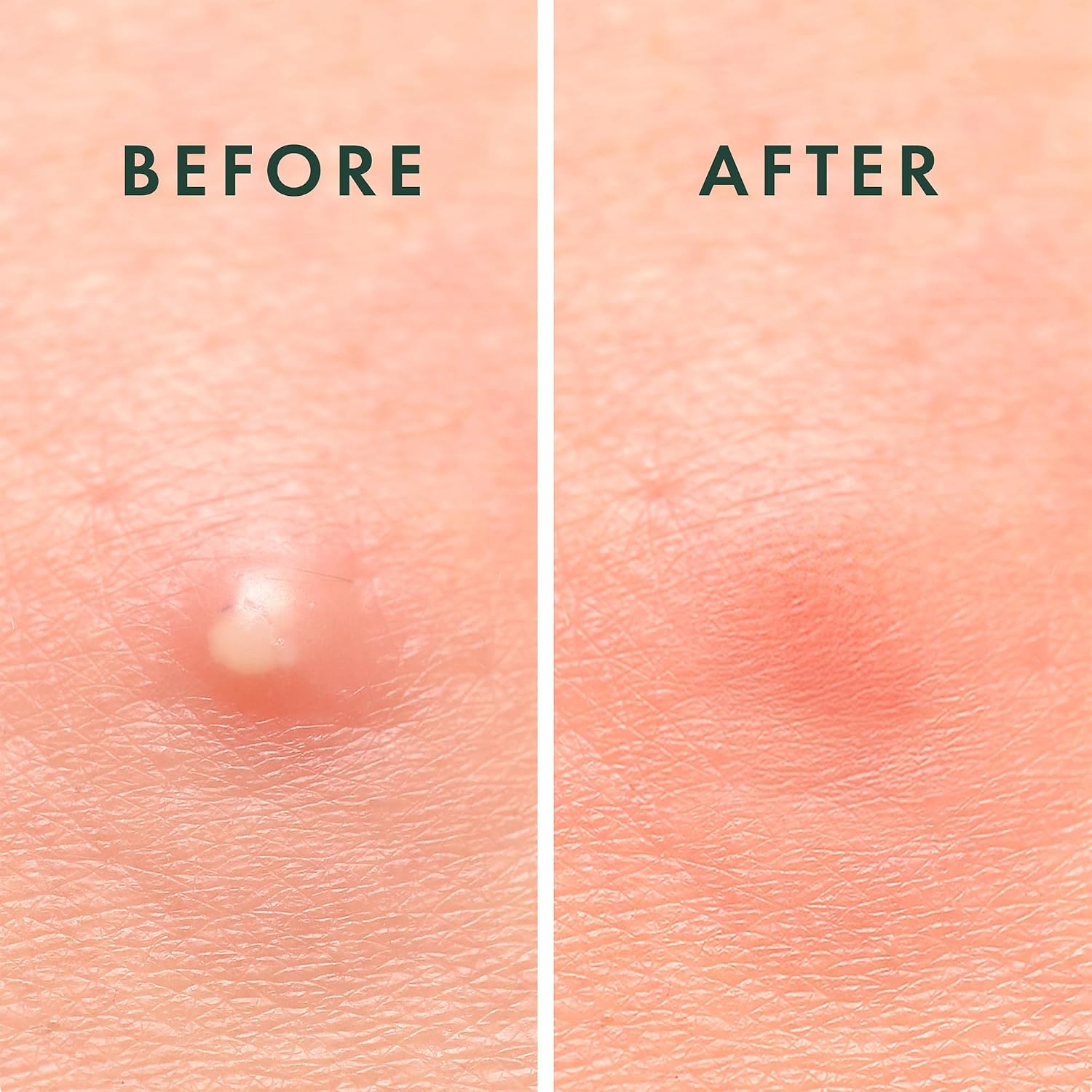 hypoallergenic, non-drying formulation safe for all skin types