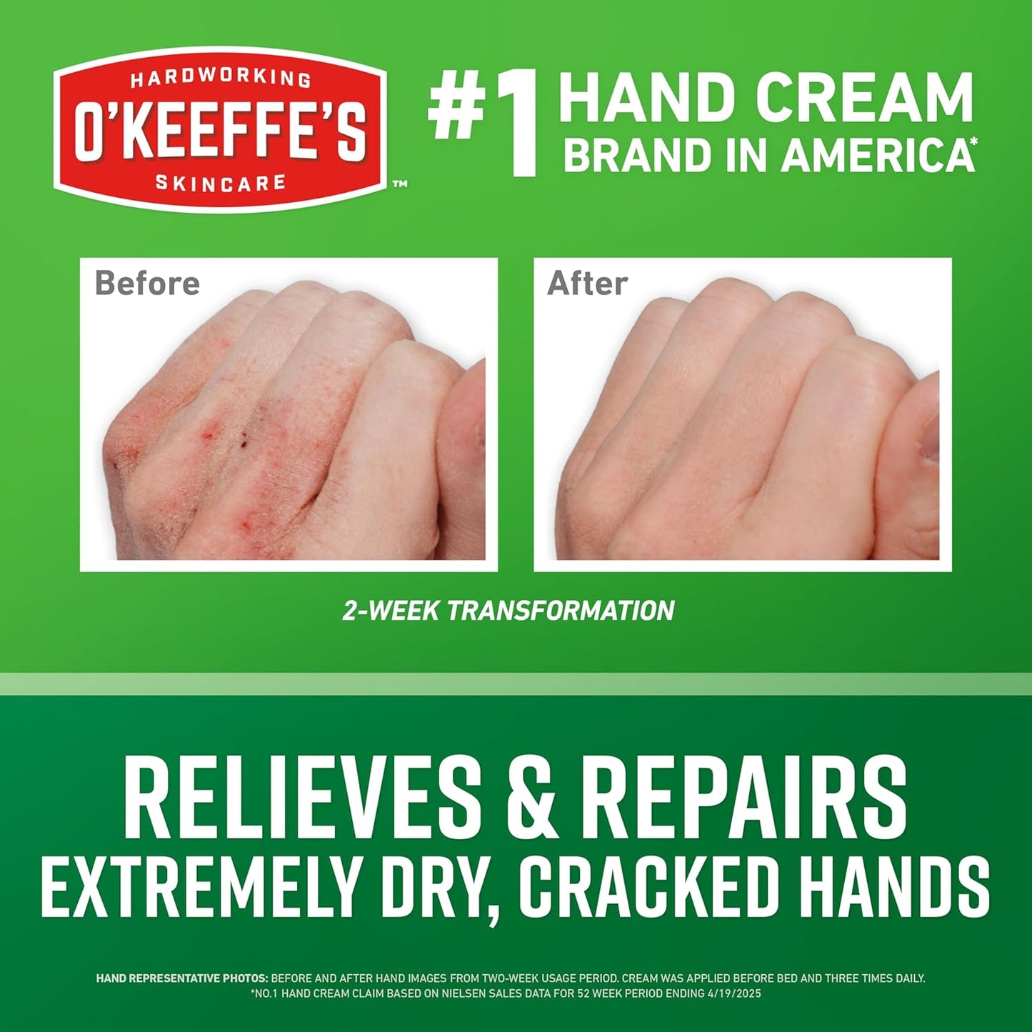 hypoallergenic, unscented, and non-greasy formula