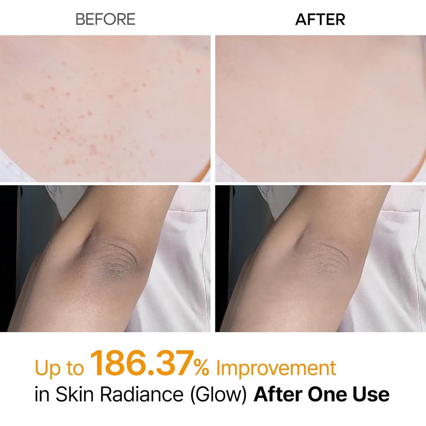 kojic acid for melanin-inhibiting brightening effect on dark spots