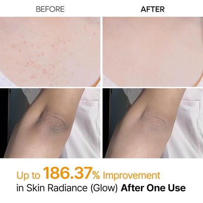 kojic acid for melanin-inhibiting brightening effect on dark spots